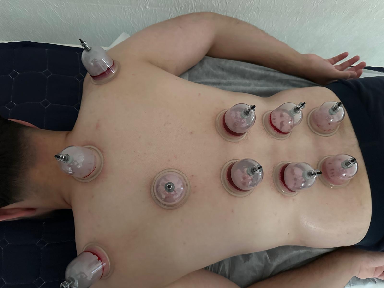 Treatment Bed